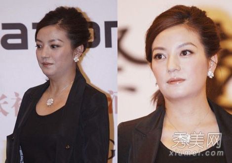 盤點產后發福女星王艷雙下巴明顯