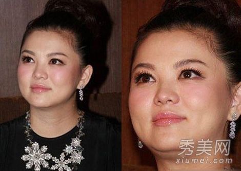 盤點產后發福女星王艷雙下巴明顯